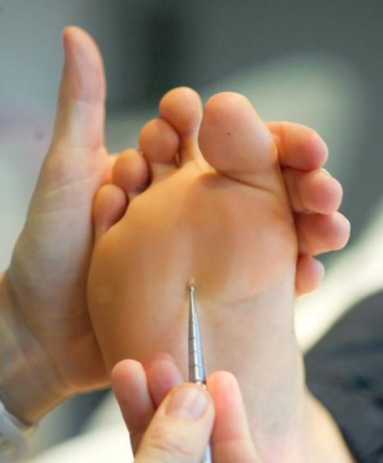 붓기 혈자리 마사지보다 먼저 알아야 할 포인트