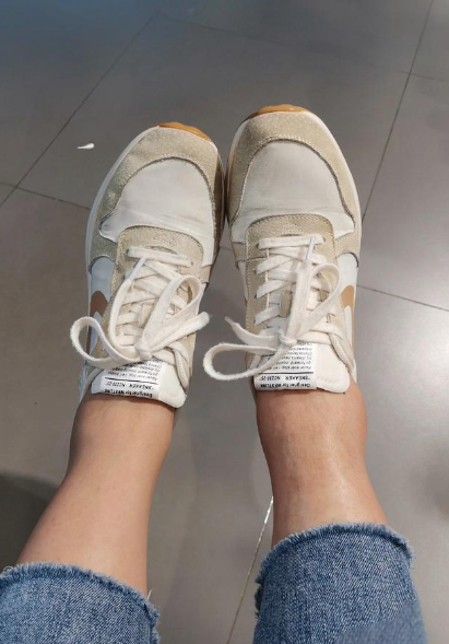 발목 붓기 원인 무거운 발목이 보내는 신호 해석하기