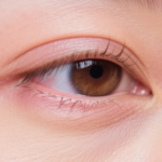 눈이 붓는 이유 아침마다 달라지는 붓기